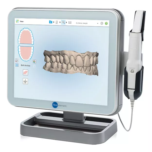 TKC Itero Scan 3D Itero Scan for Clear Invisalign Aligners at the Knightsbridge Clinic