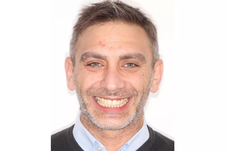 After Invisalign treatment After Invisalign treatment