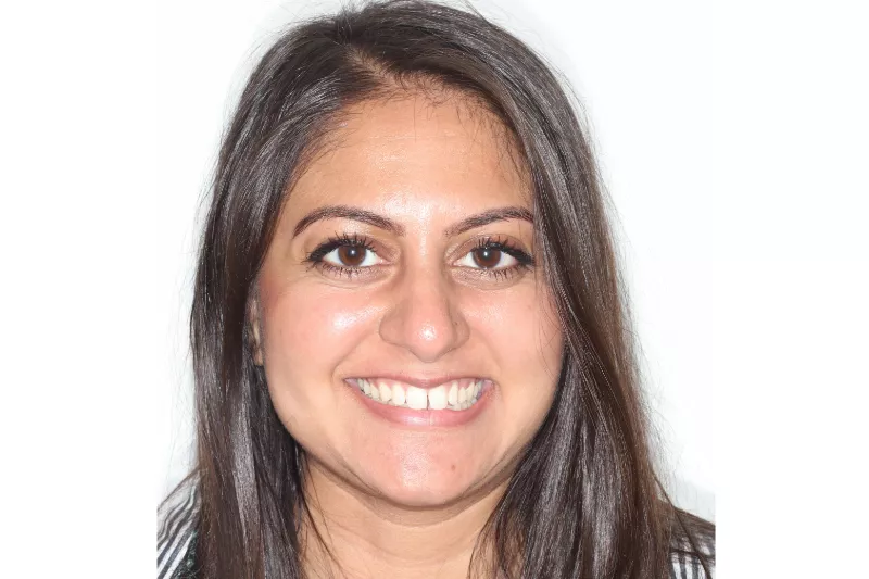 Before Invisalign Lite Before Invisalign Lite