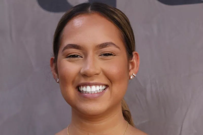 Fixed Braces and Whitening Fixed Braces and Whitening