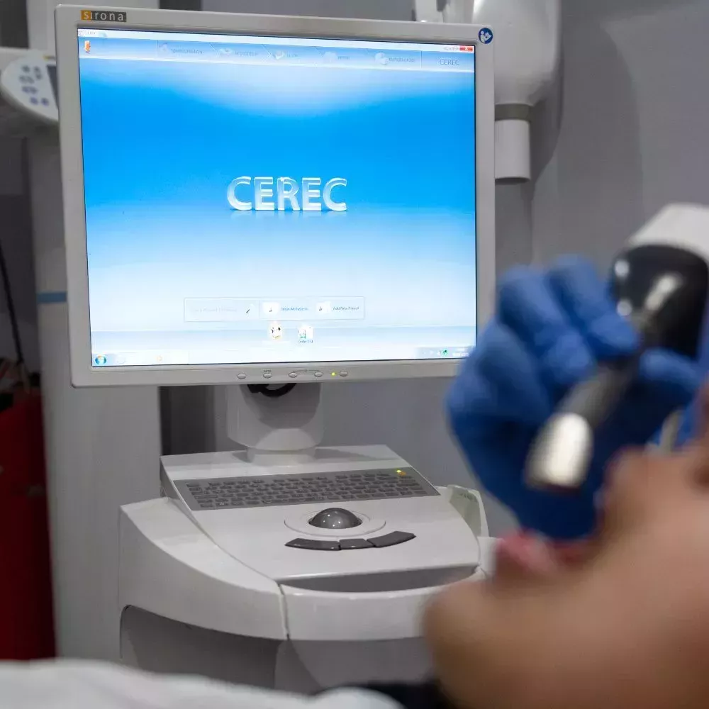 Same day cerec crown