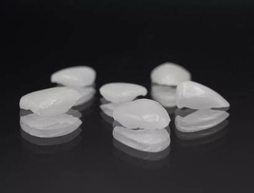 Hand made veneers TKC Porcelain Veneers at the Knightsbridge Clinic