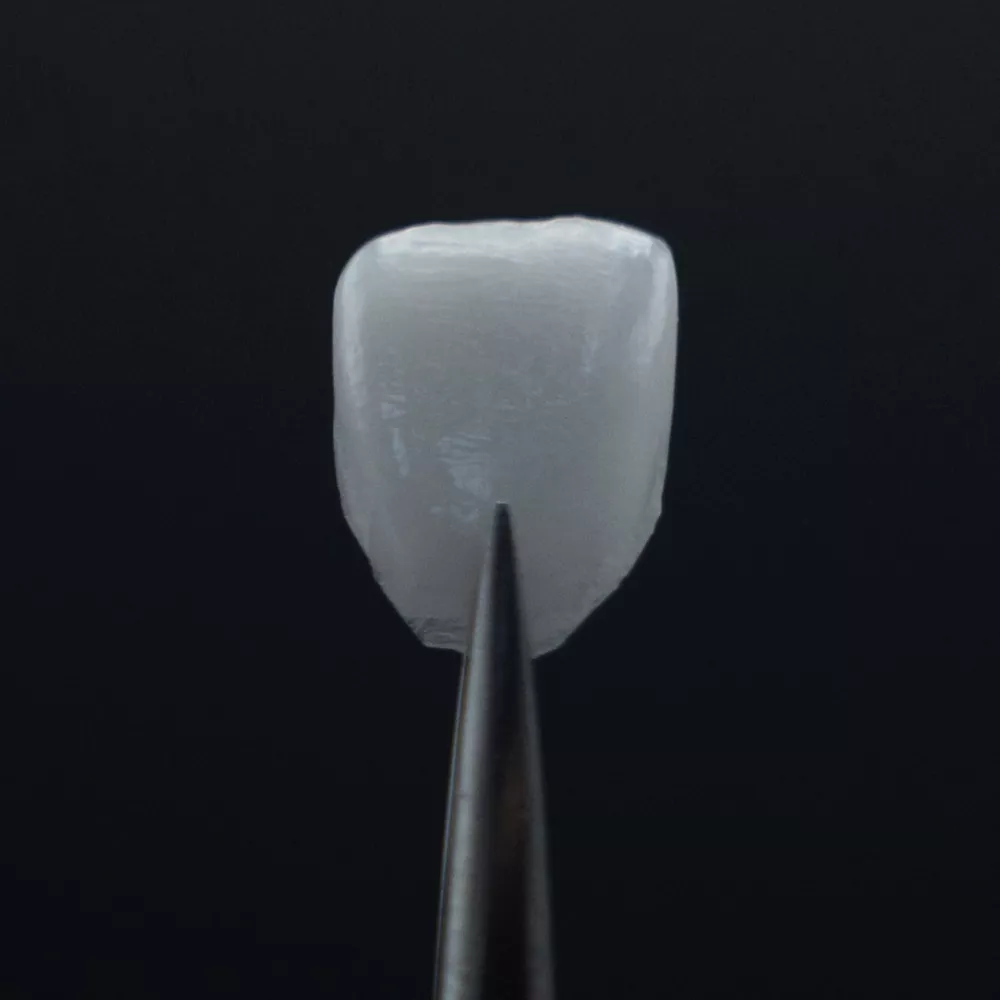 Porcelain Veneers Feldspathic lifelike veneers at The Knightsbridge Clinic