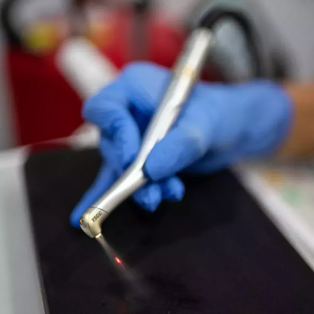 gum contour without scalpel and stitches by Dr Sheraz Aleem