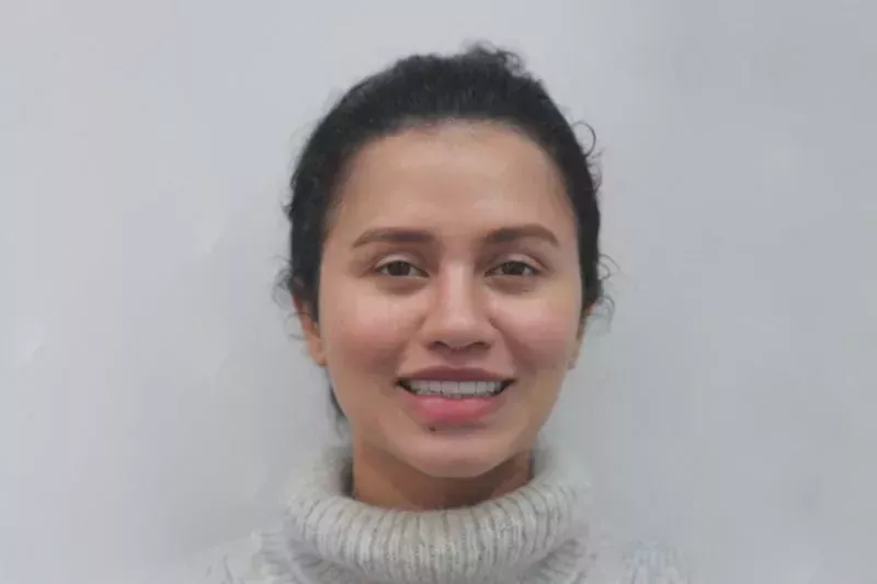 Smile Design with porcelain veneers