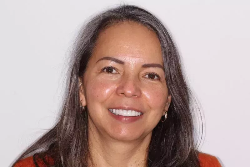 Smile transformation with Porcelain Veneers