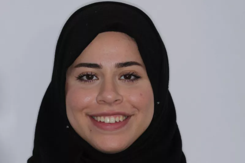 Smile Before Invisalign Aligners Smile Before Invisalign Aligners