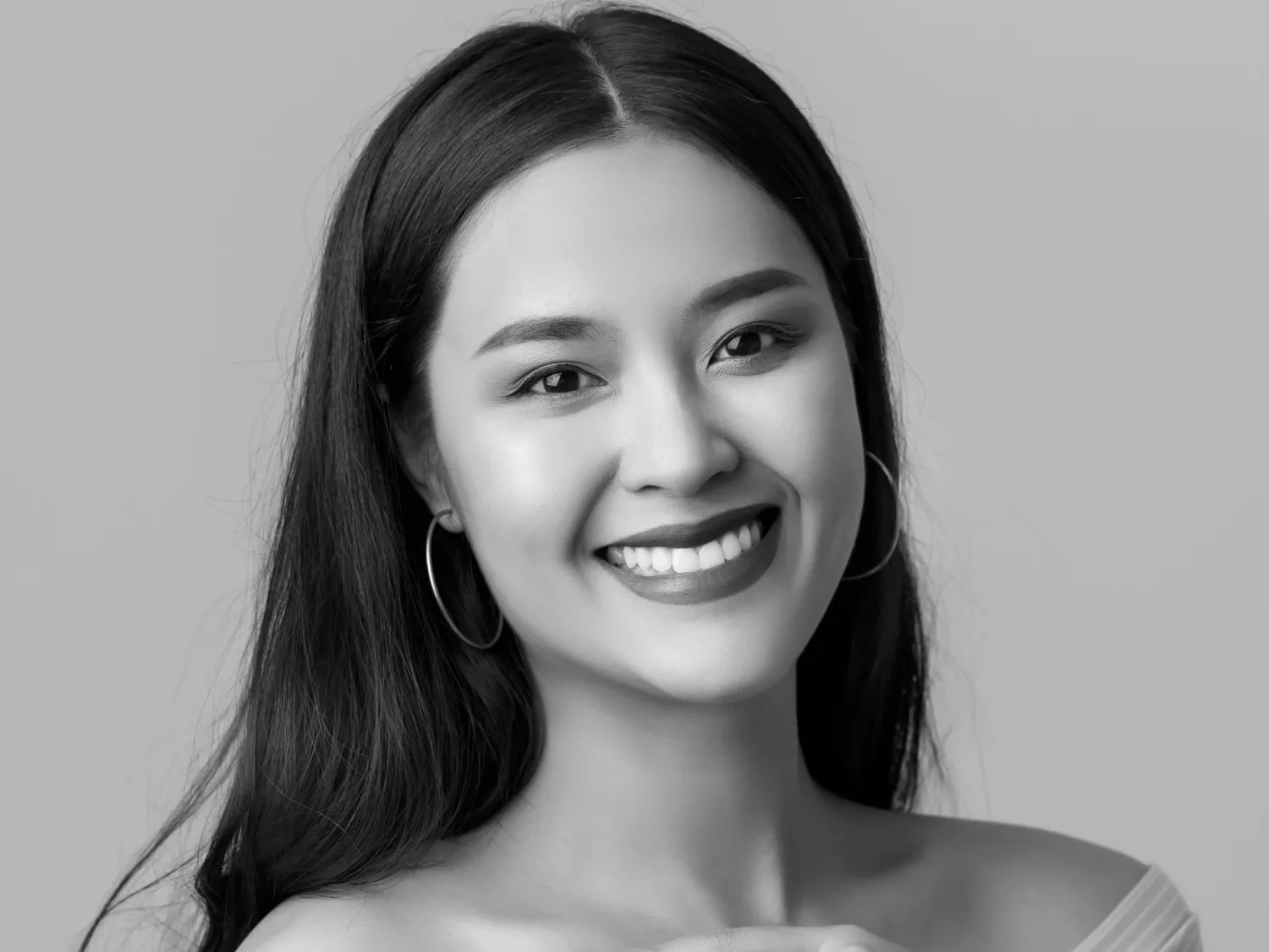 Composite bonding The Knightsbridge Clinic Lifelike composite bonding veneers at The Knightsbridge Clinic