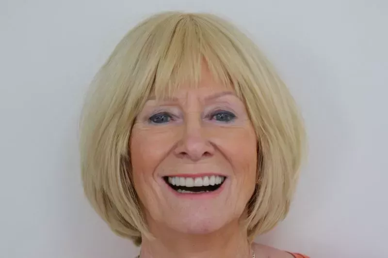 Smile Design by Dr Sheraz Aleem