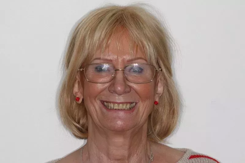 Smile Design by Dr Sheraz Aleem