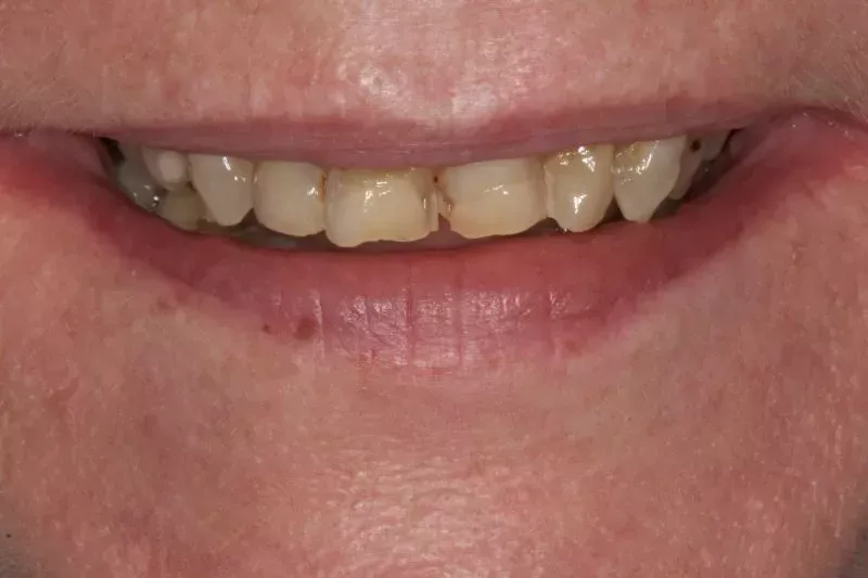 Smile Design by Dr Sheraz Aleem