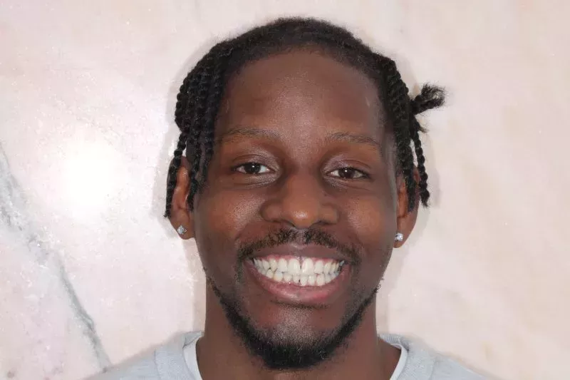 After composite bonding