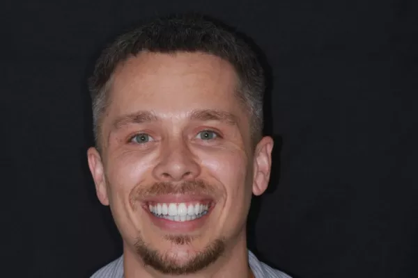 Invisalign Central London