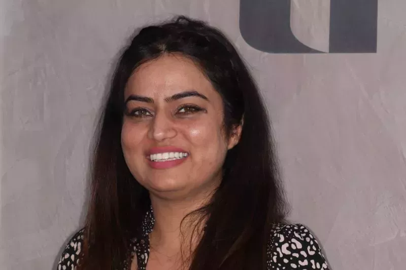 after dental veneers