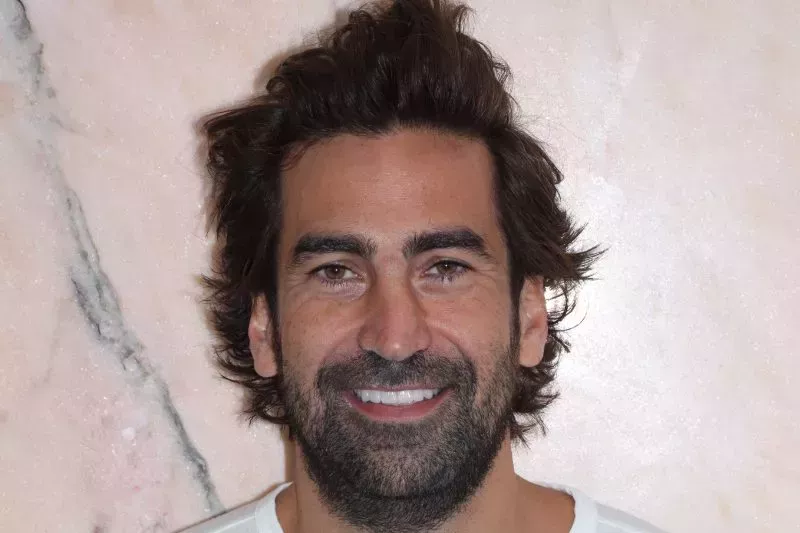 After Non cutting veneers