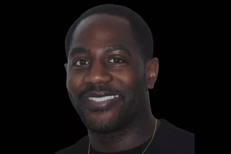 After Invisalign treatment