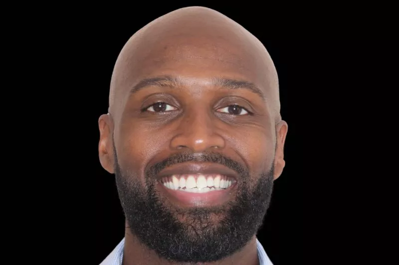 AFTER INVIS AFTER INVISALIGN BY DR ALEEM