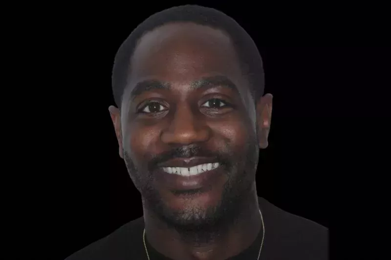 After Invisalign treatment