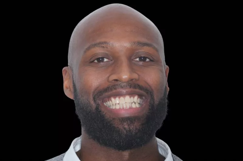 BEFORE INVIS BEFORE INVISALIGN TREATMENT