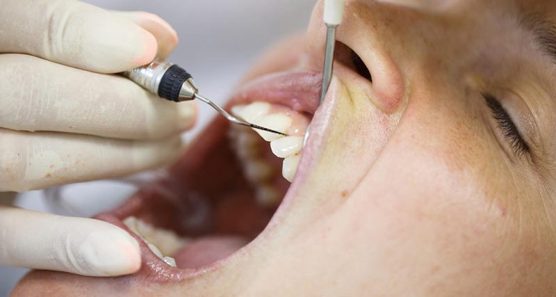 gum treatment london