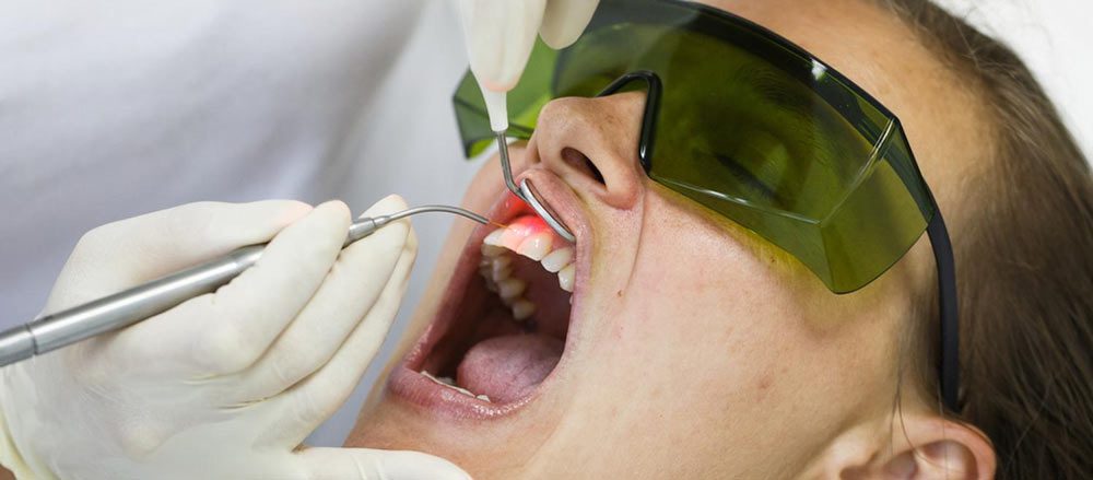laser treatment for gum disease