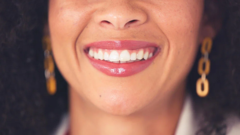 how much do no prep veneers cost in the uk?