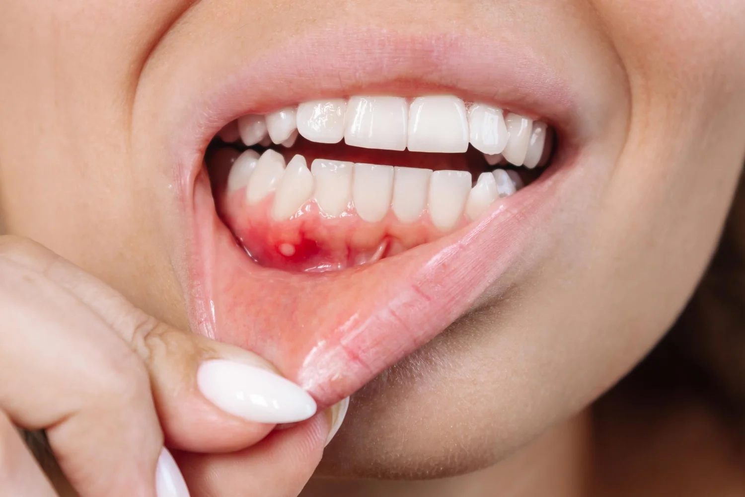 receding gums treatment