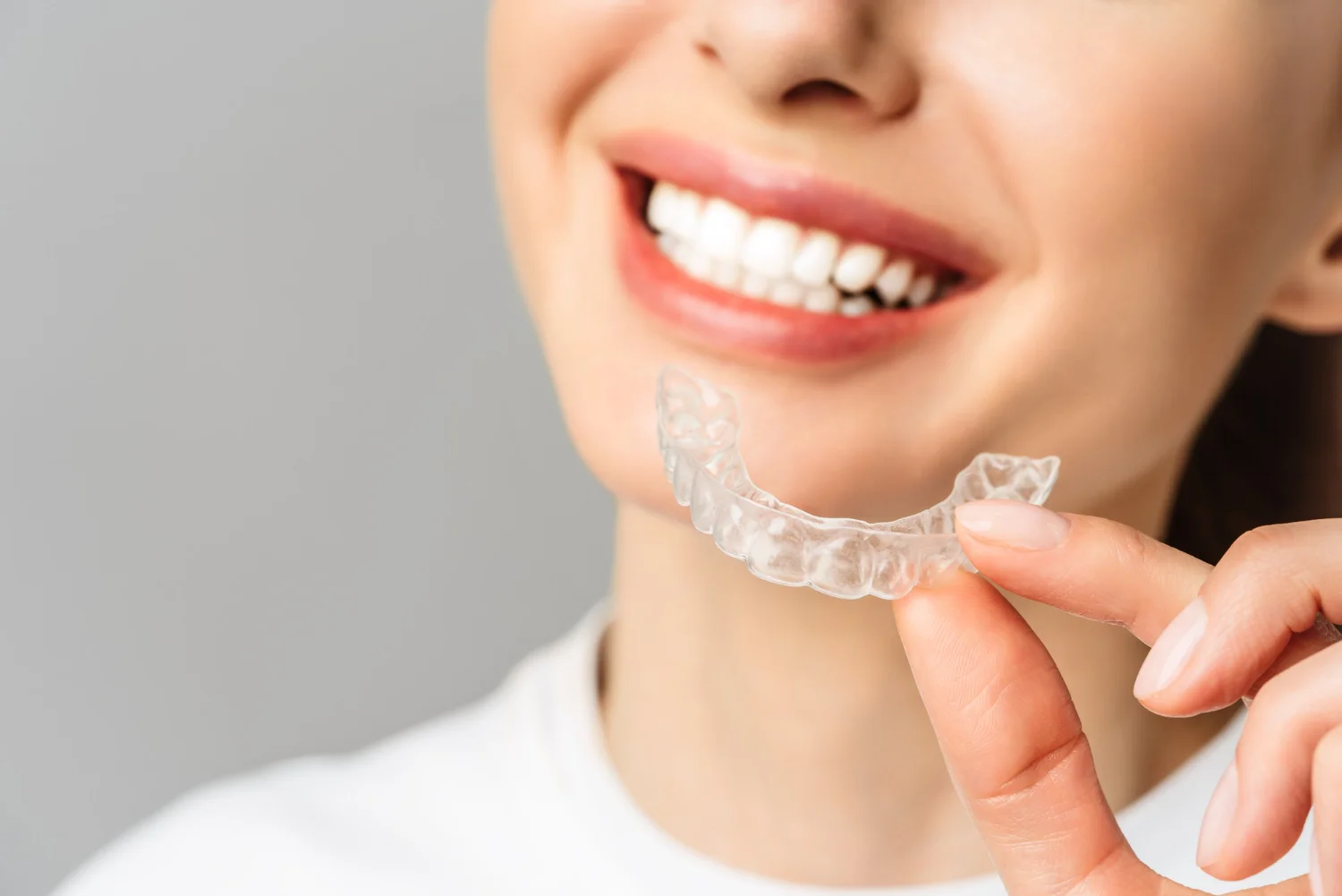 invisalign london